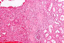 H&E of kidney tissue