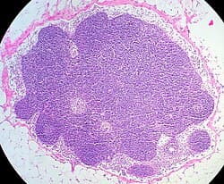 H&E of lymph node tissue