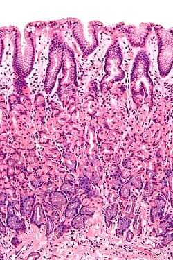 H&E of stomach tissue