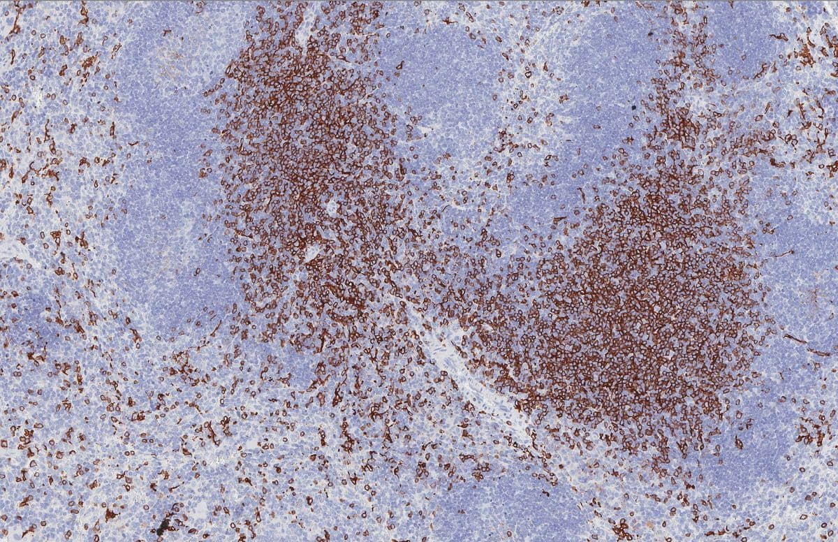 IHC on mouse spleen