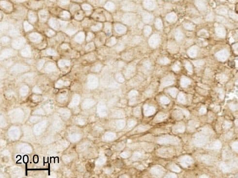 Brightfield IHC: tumor