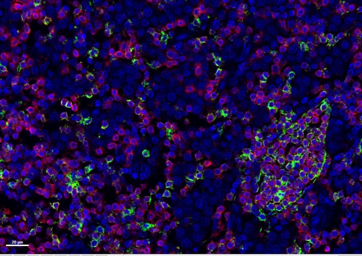 Multiplex immunofluorescence: lymphoid tissue